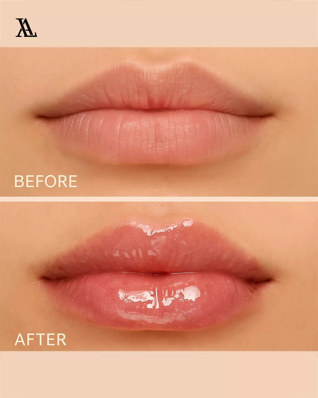 LA RÊVE Extreme Lip Plumper – Gold Edition - Image 9